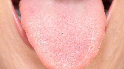 吃瓜舌头麻木,揭秘奇特现象背后的真相 第2张 吃瓜舌头麻木,揭秘奇特现象背后的真相 第2张