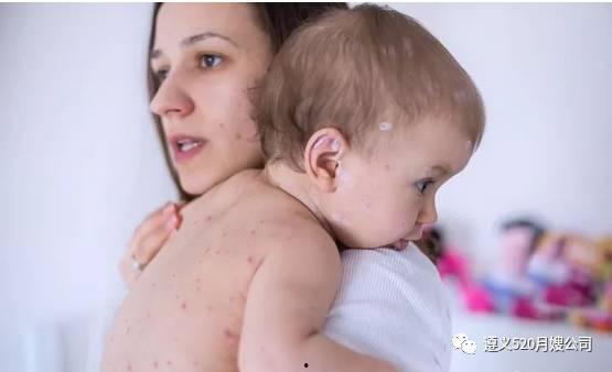 宝宝吃黄皮瓜过敏吗,过敏风险知多少  第2张