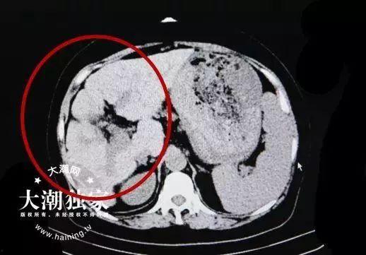 吃瓜CT,一场关于网络热点的深度探讨 第3张 吃瓜CT,一场关于网络热点的深度探讨 第3张